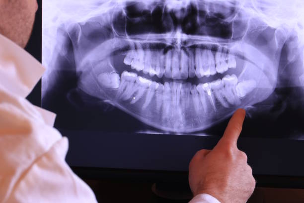 Best Pediatric Emergency Dentist in Jessup, MD
