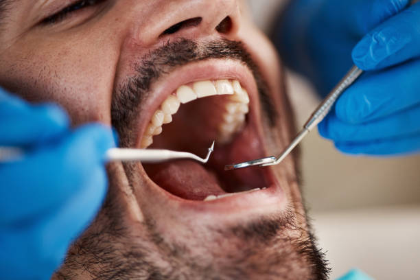 Best Broken or Cracked Tooth Emergency Dentist in Jessup, MD