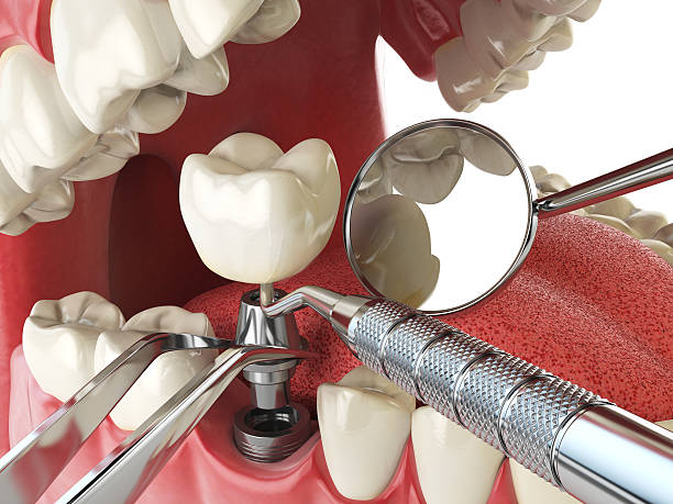 Best Emergency Dental Services for Seniors in Jessup, MD